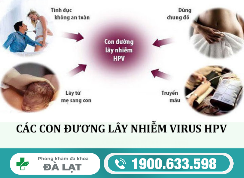 Hình ảnh minh họa